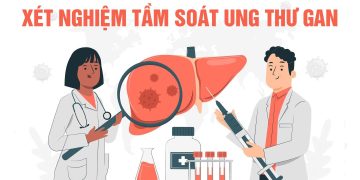 Chẩn đoán ung thư gan sớm bằng AFP giúp kéo dài sự sống