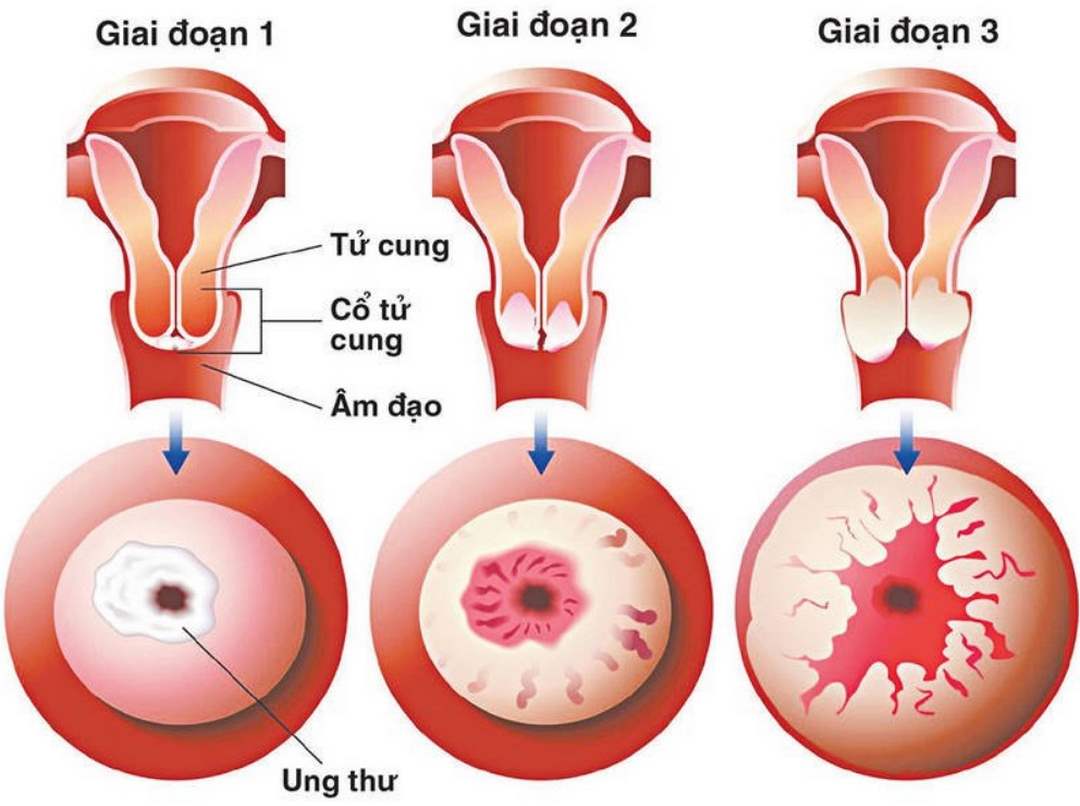 Nguyên nhân của căn bệnh